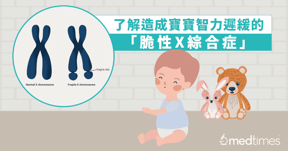 【遗传疾病】了解造成宝宝智力迟缓的「脆性X综合症」